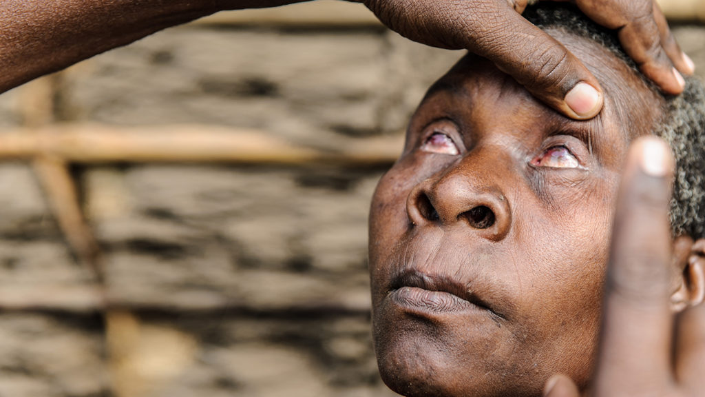 Beneficiary Aluna Bakari Kambinje (70) being examined by Dr Mwita in Likuyu, Ruangwa, Tanzania